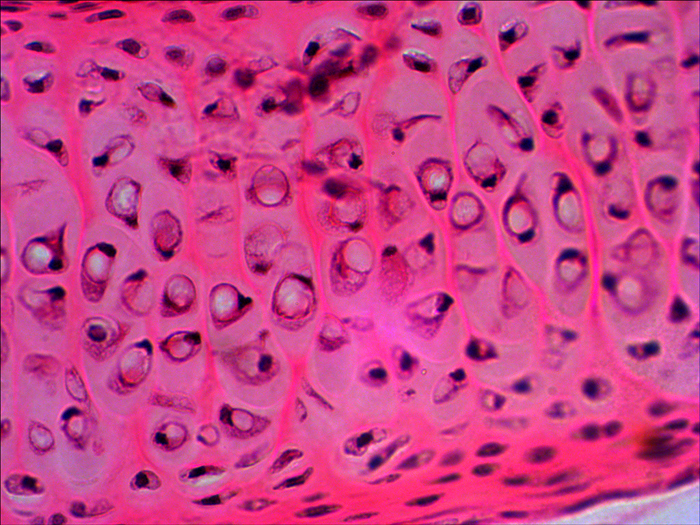 15-Hyaline-cartilage.jpg 15-Hyaline-cartilage.jpg