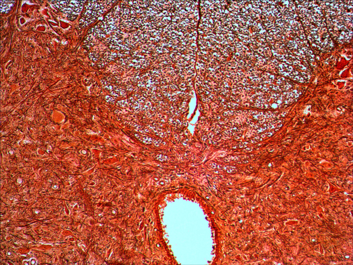 14-Nerve-cells.jpg 14-Nerve-cells.jpg