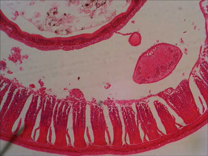 15-Earthworm.jpg 15-Earthworm.jpg